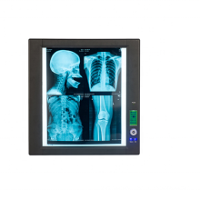 2020 New Style High luminance Super thin single panel negatoscopio led medical x-ray film viewer